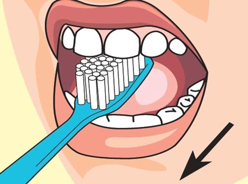 Как максимально защитить свои зубы от кариеса?